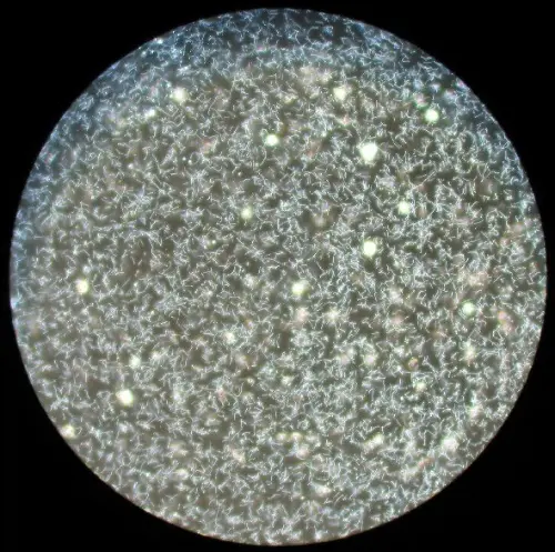 Leptospirosis darkfield